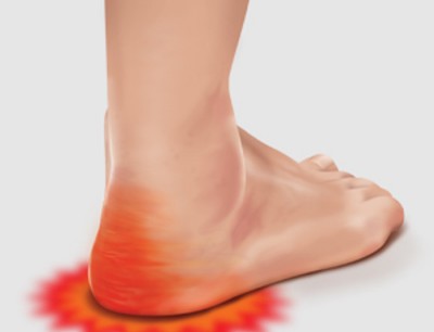 How long does peroneal tendinitis last