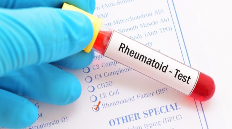 النسبة الطبيعية للروماتويد