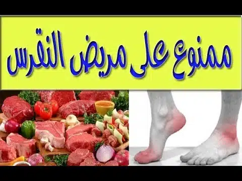 ما هي أهم الأكلات الممنوعة لمرضى النقرس؟
