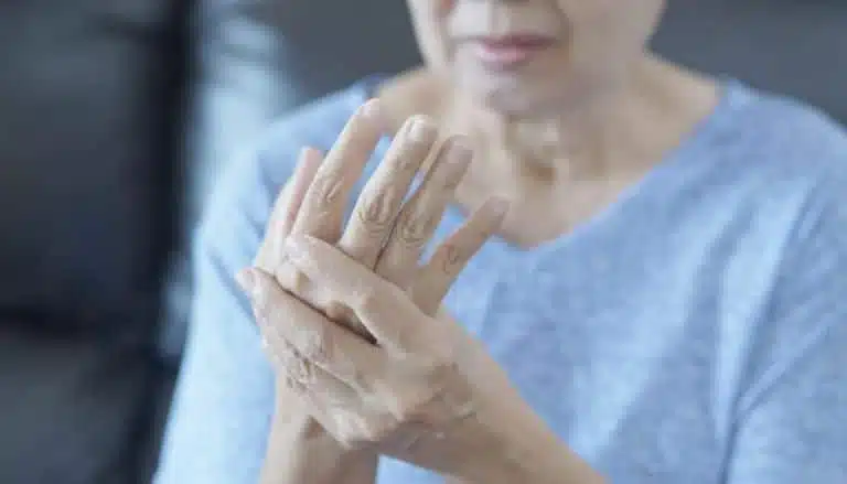 اسباب مرض الروماتويد