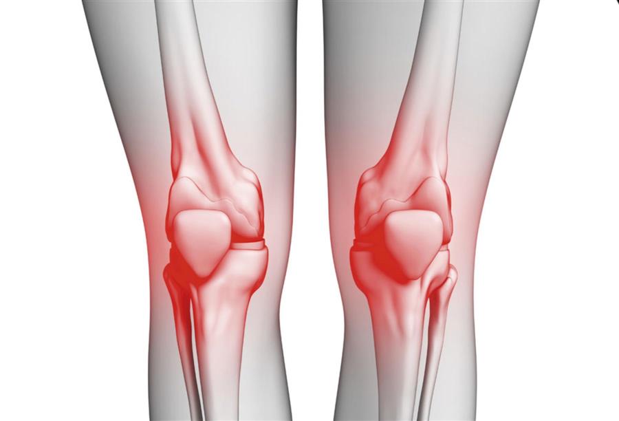 Learn more about treating knee osteoarthritis