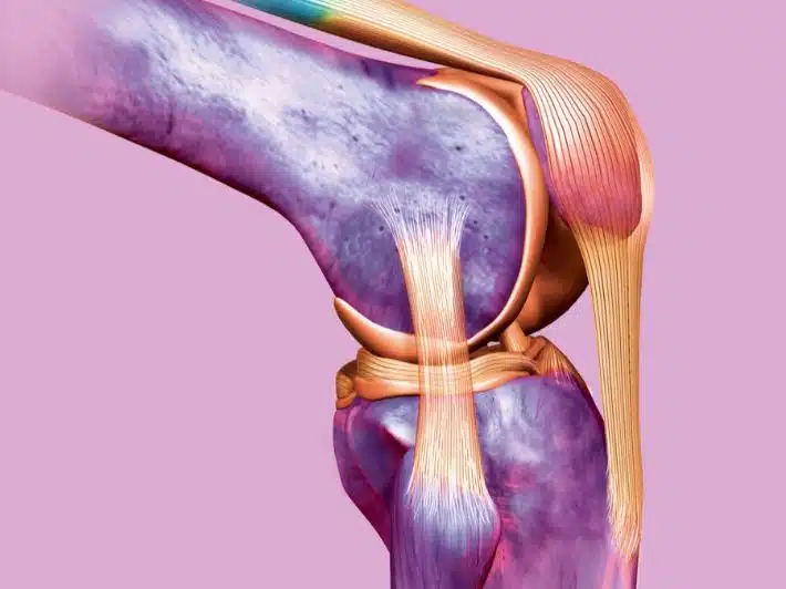 علاج الرباط الصليبي 1