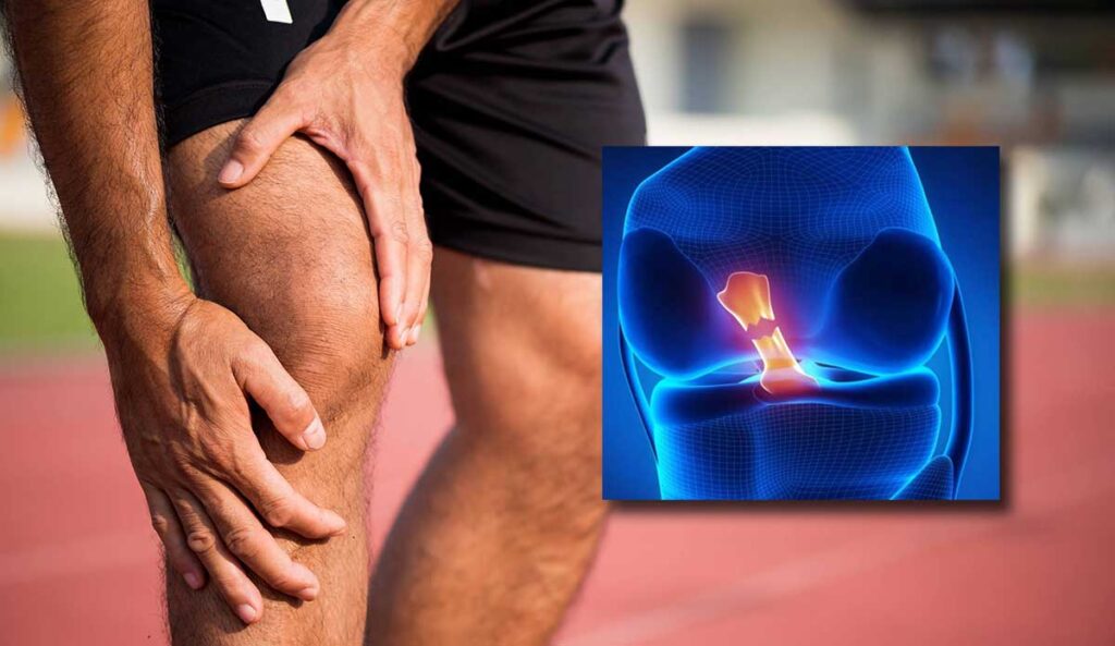 ما هي عملية الرباط الصليبي؟