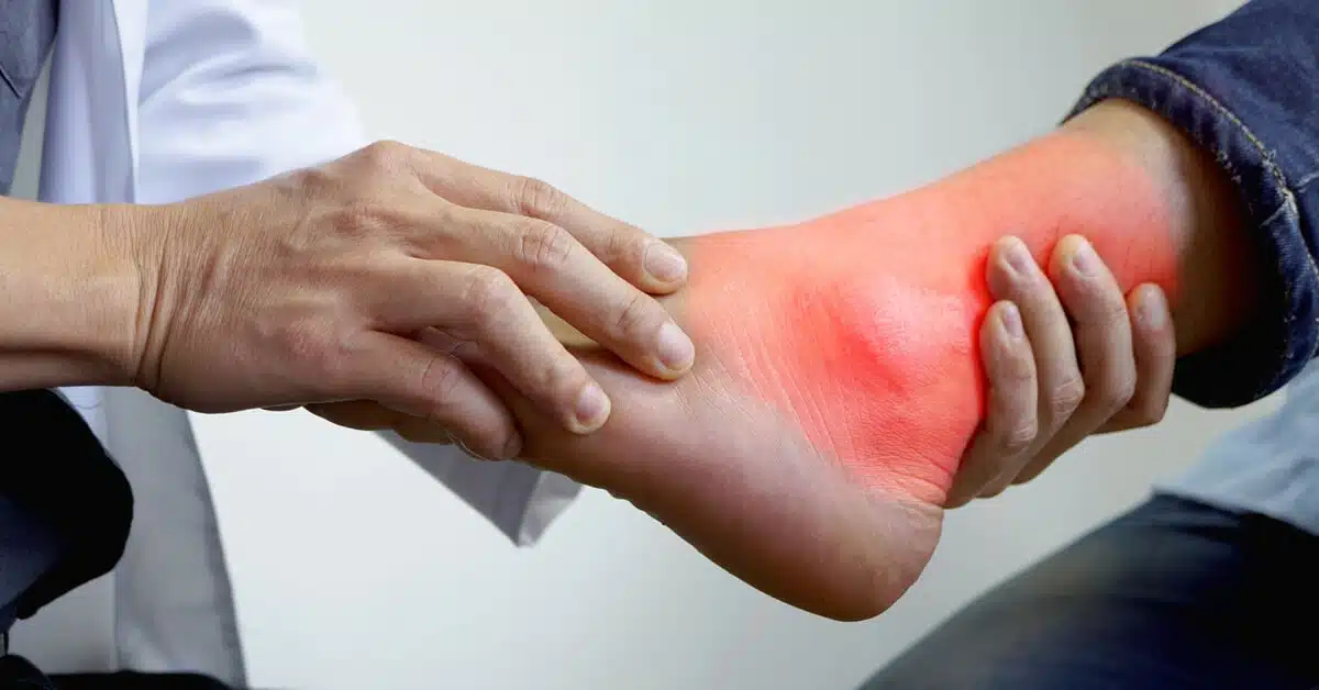 أعراض النقرس