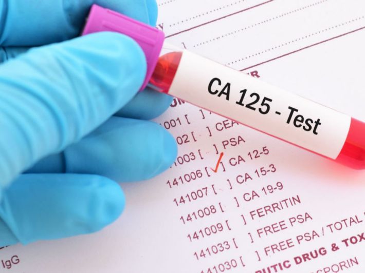 تحليل الكالسيوم ca