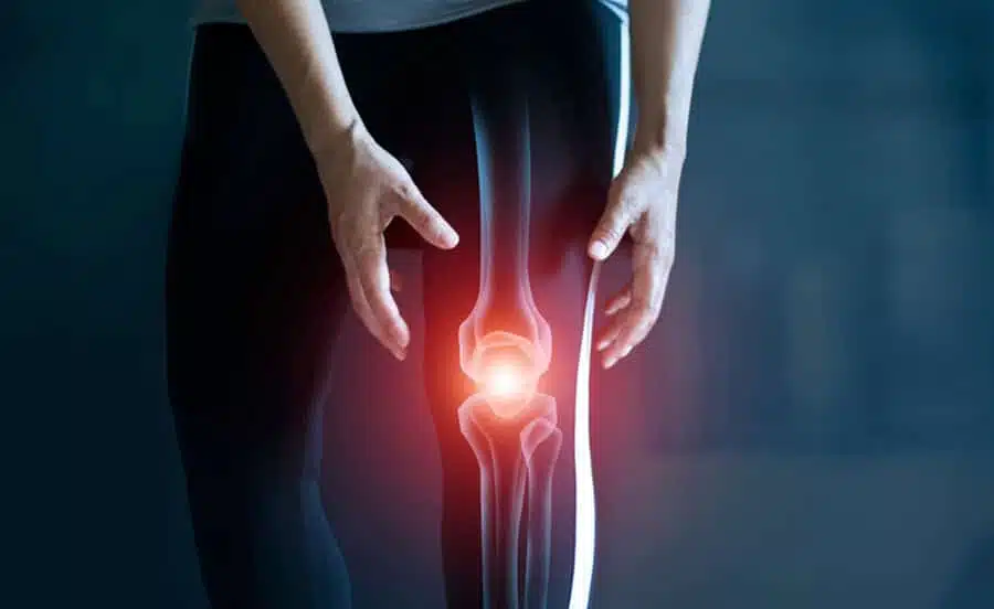 هل لا بد من زيارة الطبيب حين الشعور بسخونة في المفاصل؟