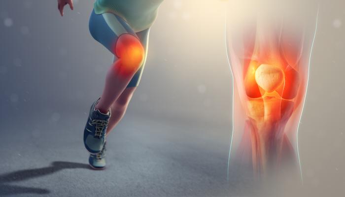 علاج تحرك صابونة الركبة من مكانها وكيفية استخدام الأعشاب للعلاج