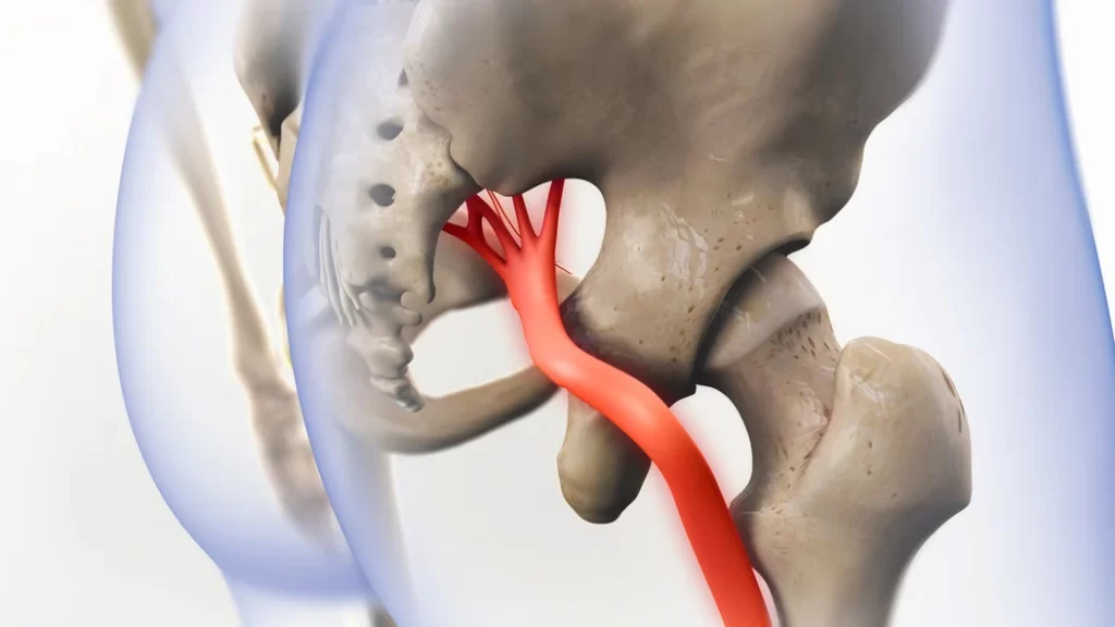 تعرف على علاج عرق النسا وما هي أسبابه؟