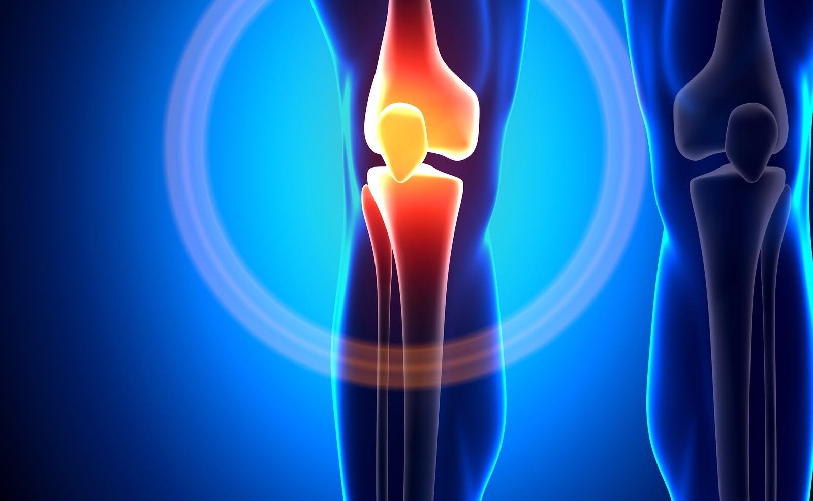 ما لا تعرفه عن قرحة الركبة وما هي أعراضها وطرق علاجها؟