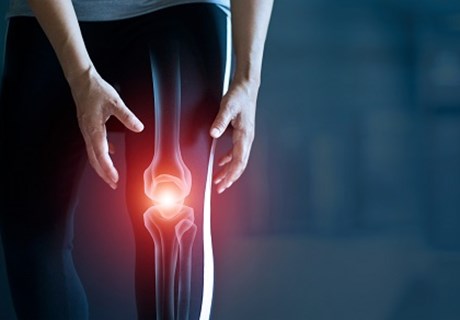 ما هو علاج احتكاك عظام الركبة؟ وما هو الفرق بين الاحتكاك والخشونة؟