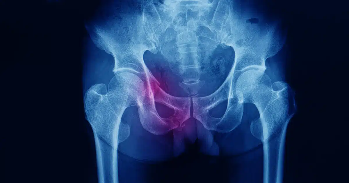 Tbl articles article 31198 213c67fb46e 5b95 4ab1 bcb2 6ab85e64e065 1