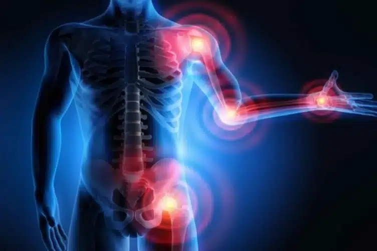 ما هي أمراض العظام؟