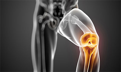 ما هي أضرار عملية غضروف الركبة؟ وما هي نسبة نجاحها؟