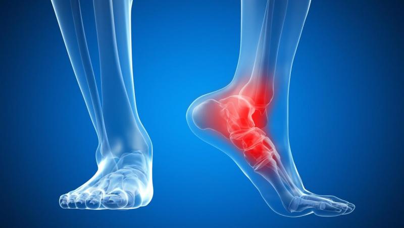 ألم في عظمة القدم الجانبية ومتى يكون ألم القدم خطير؟