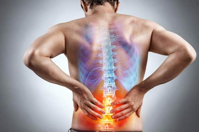 كم نسبة نجاح عملية العمود الفقري؟