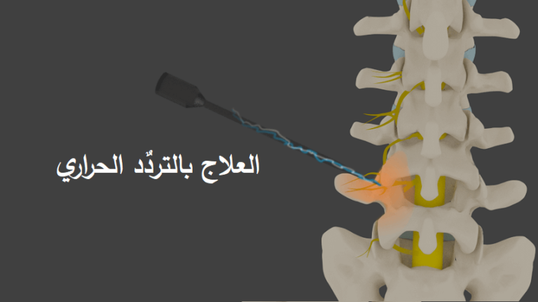 التردد الحراري علاج ام مسكن