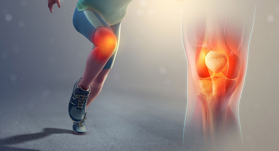 اعرف أكثر عن التواء الركبة وما هي أسبابها وأعراضها؟