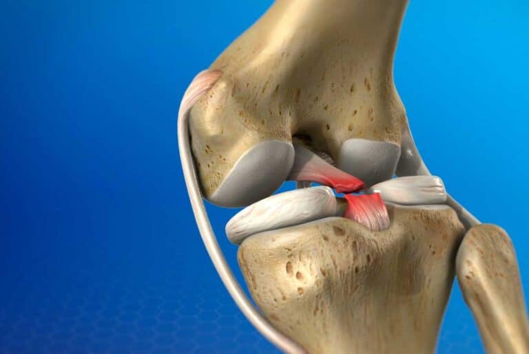 الرباط الصليبي الخلفي