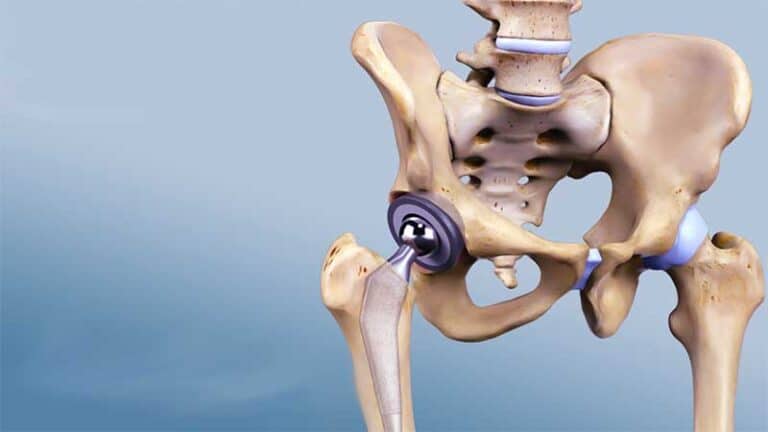 انواع مفاصل الحوض