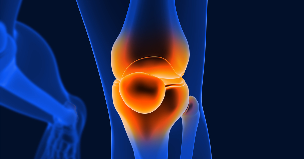ما هو علاج تيبس الركبة؟ وما هي مضاعفاته؟