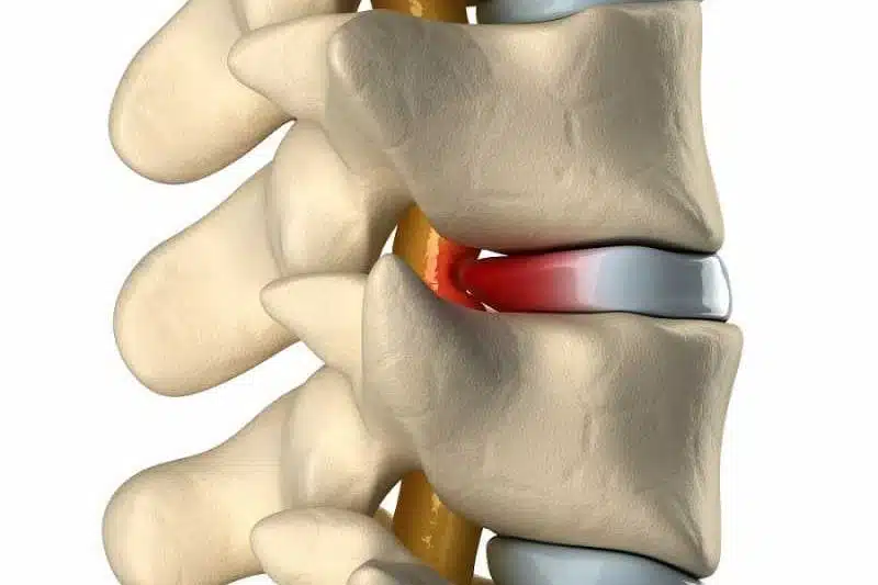 ما هي أنواع الغضروف؟