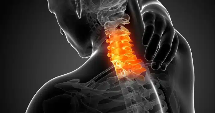 أسباب ضغط الفقرات العنقية