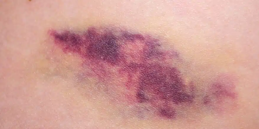 Tbl articles article 36452 757cc70be33 9a61 4463 9840 ea6b1bb7dd7d