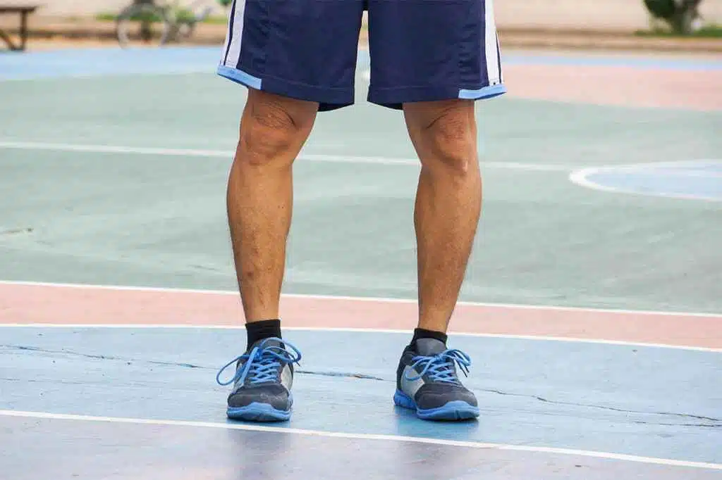 متى يستدعي تقوس الساقين الجراحة؟