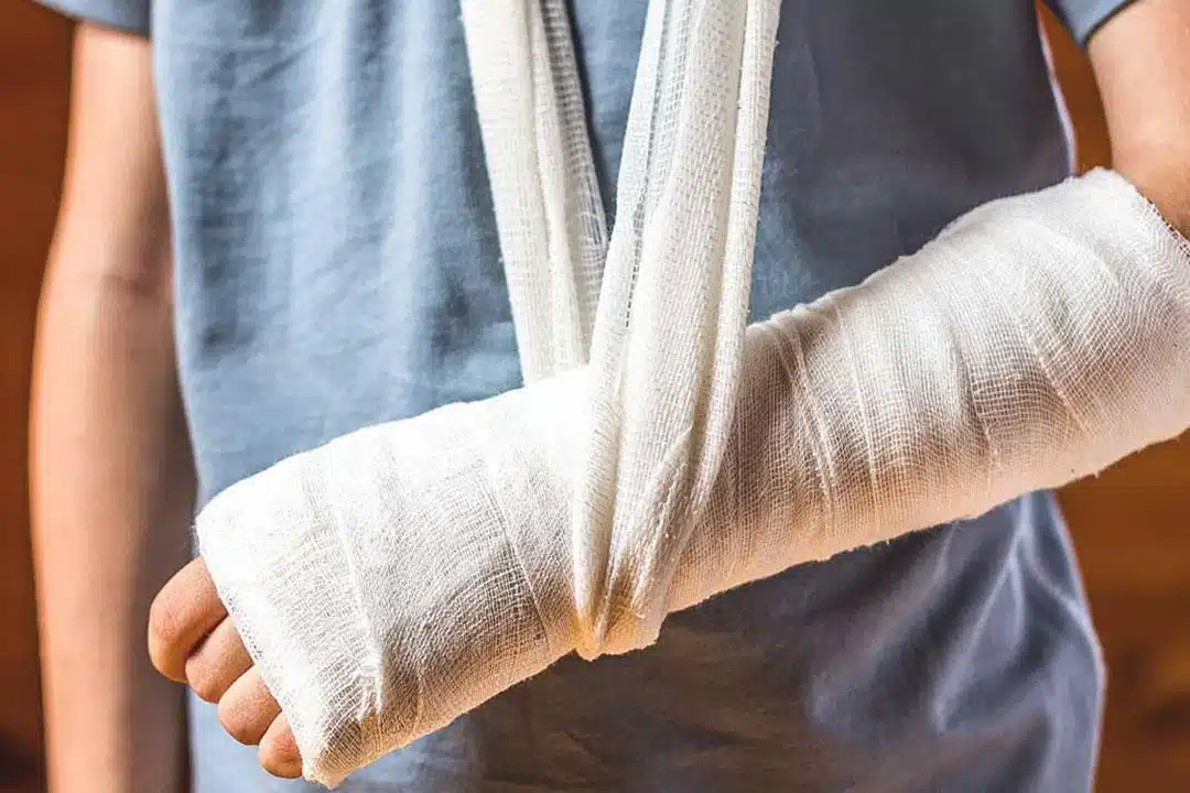 سعر عملية تركيب شريحة ومسامير في الذراع