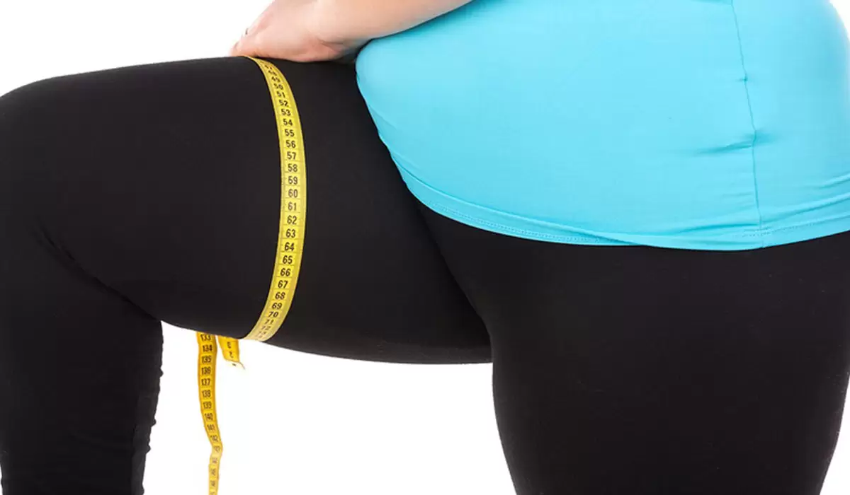 طرق علاج التصاق الفخذين