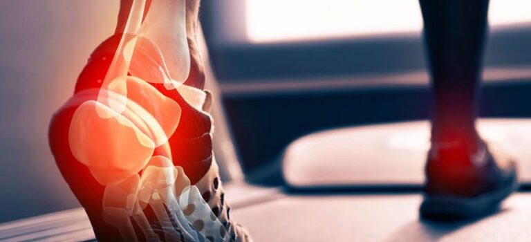 عملية وتر اكيلس