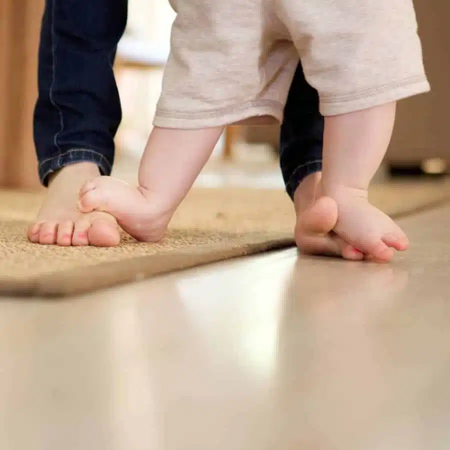 كيف اعرف أن طفلي عنده تقوس في الساقين؟