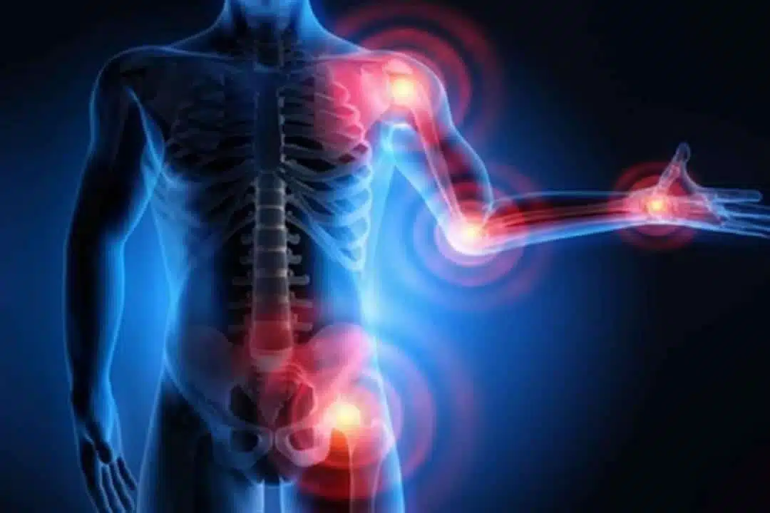 ما هو علاج التهاب المفاصل والعظام؟