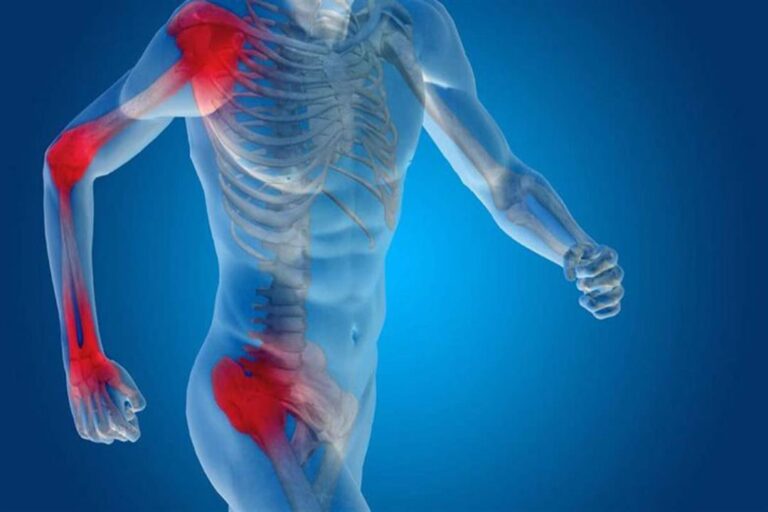 ما هي أعراض التهاب العظام والمفاصل؟