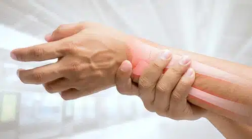 ما هي كدمات العظام؟ 1