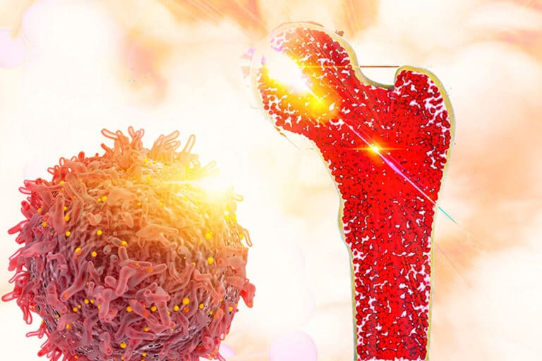 متى ترتفع المناعة بعد زراعة النخاع؟