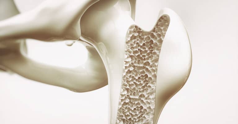 ما هي الأمراض التي تشملها جراحة العظام؟