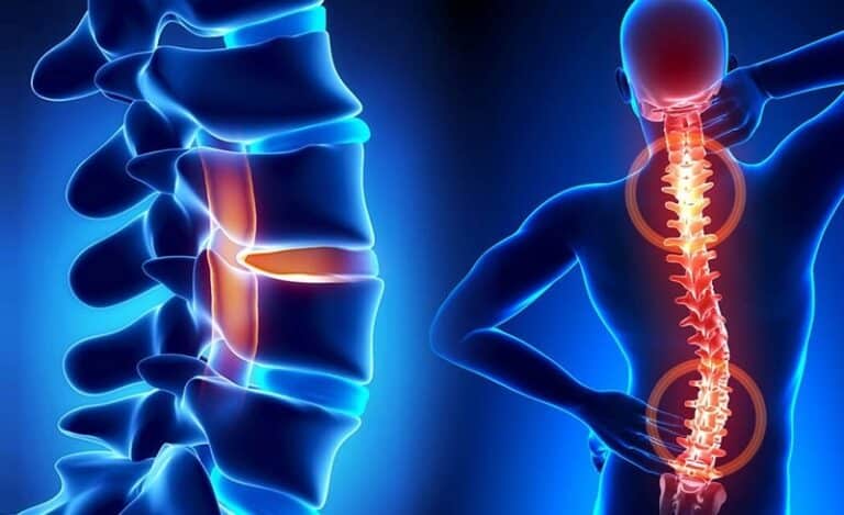 هل عملية الجنف خطيرة