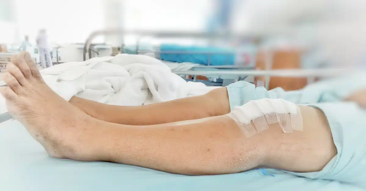 إجراءات عملية غضروف الركبة