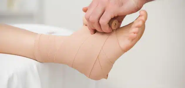 كم تستغرق عملية تثبيت الكاحل؟