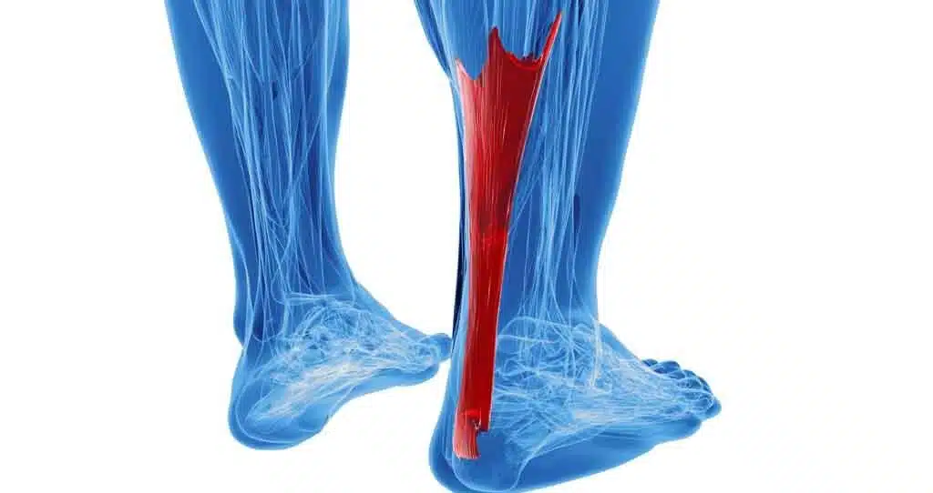 ما هي عملية وتر اكيلس؟