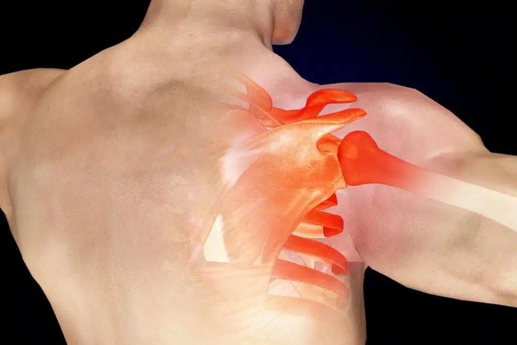 ما هي أسباب وجود ألم بعد عملية الكتف؟