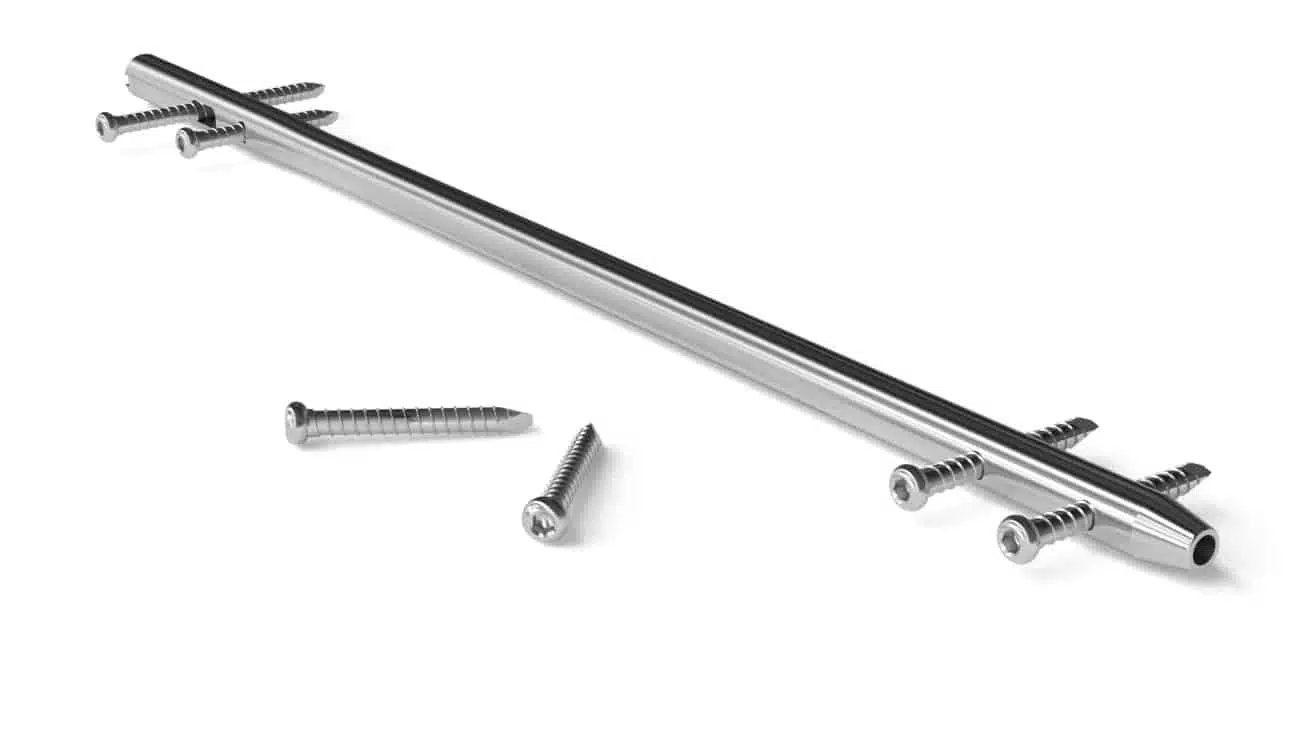 أنواع الشريحة والمسامير