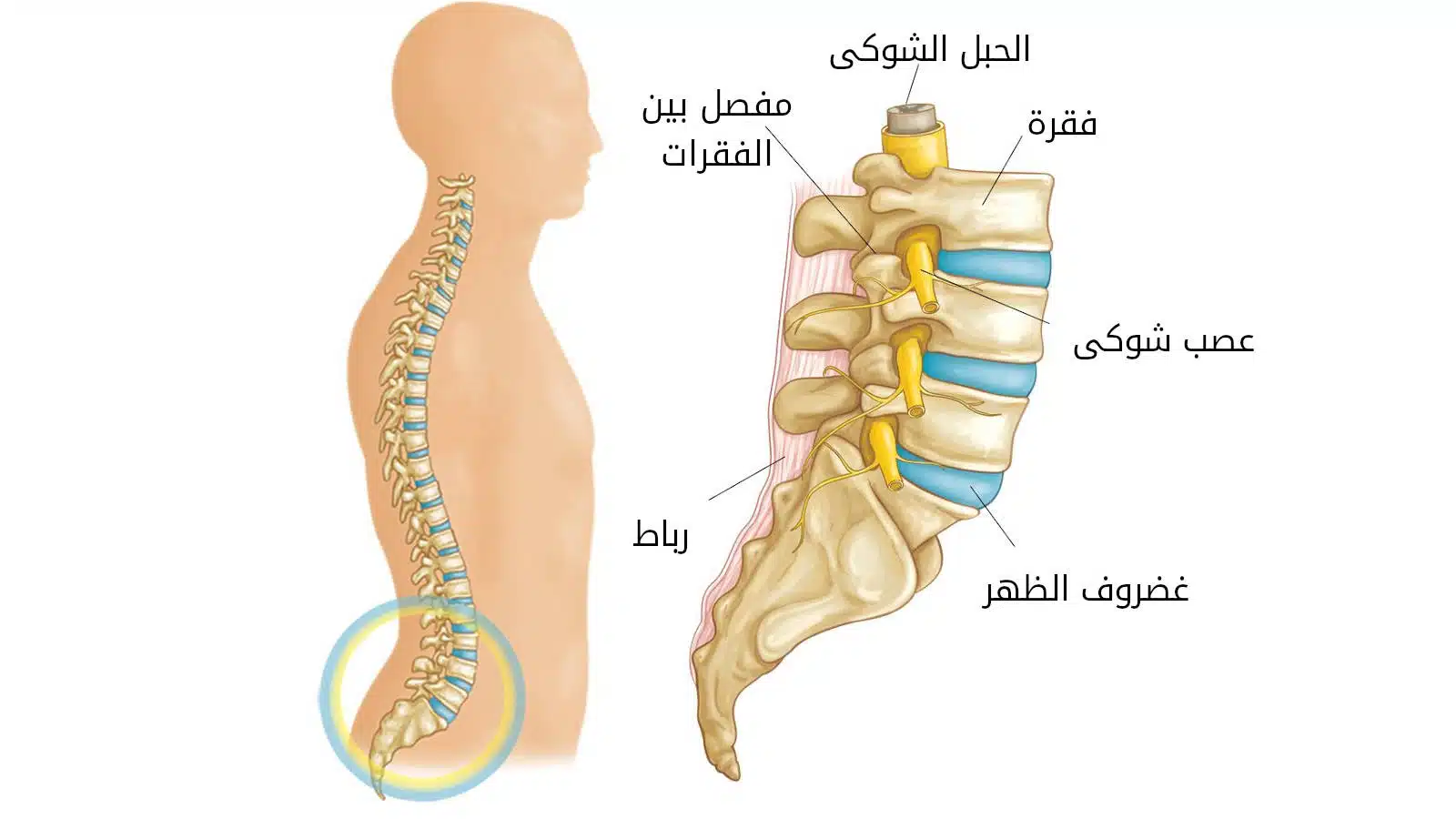 الانزلاق الغضروفي متى يصبح يحتاج عملية؟