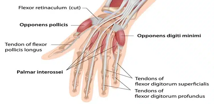 ما هي طريقة إجراء عملية أوتار الأصابع؟