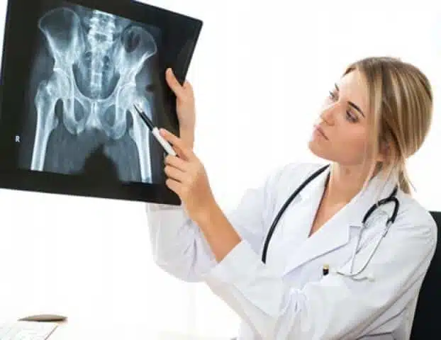 كم مدة الشفاء من كسر الحوض؟