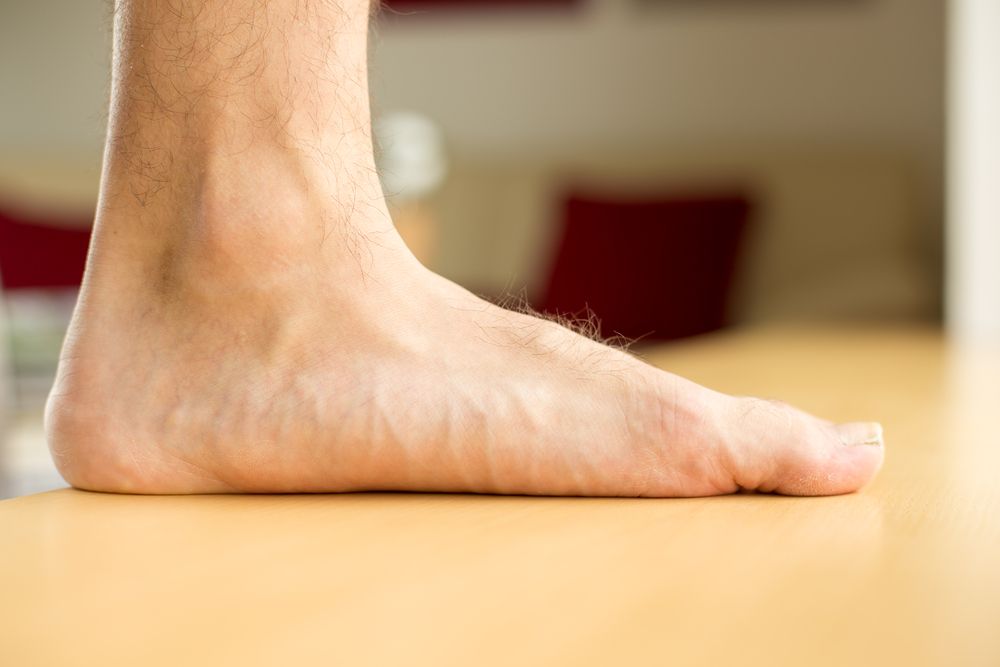 What is flat foot disease?