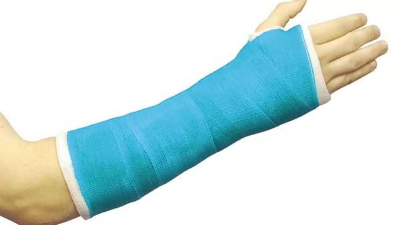 مدة عملية تركيب شريحة ومسامير في الذراع