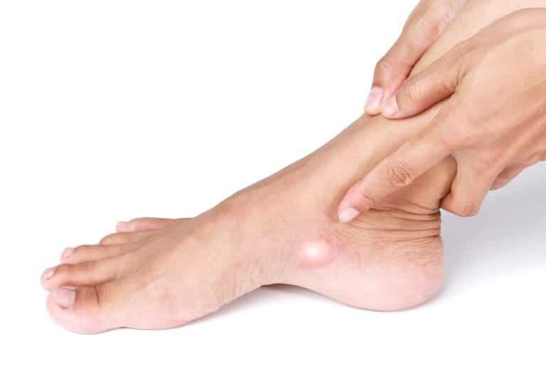 تكلفة عملية العظمة الزورقية