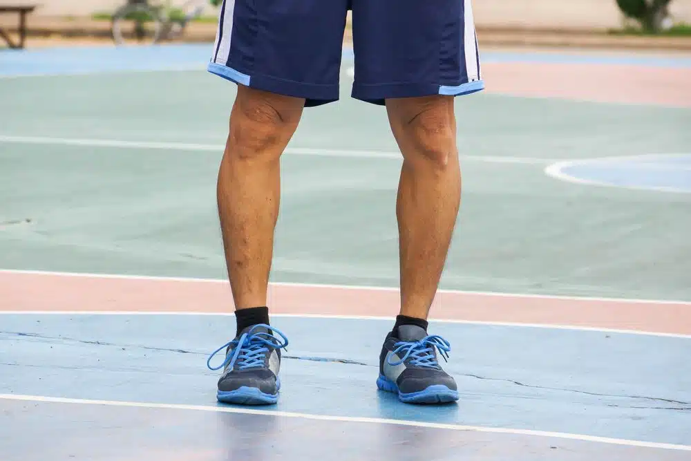 كم تكلفة عملية تقوس الساقين في مصر؟